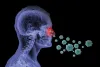 Nasal disease Sinusitis