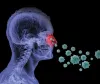 Nasal disease Sinusitis