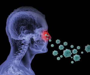 Nasal disease Sinusitis